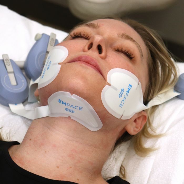 Pairing Emface® With Injectable Fillers For Comprehensive Rejuvenation 